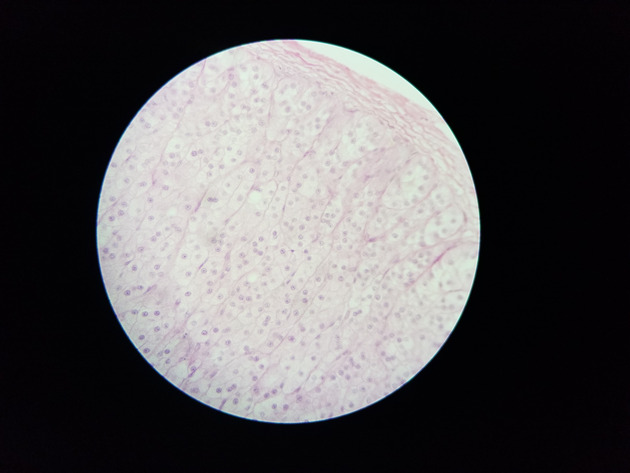 Adrenal Slides - Adrenal 007 100X